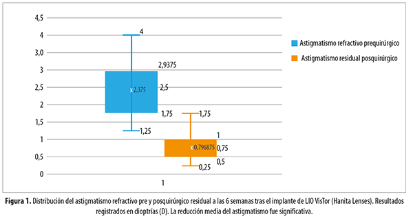 Astigmatismo discount 1 75